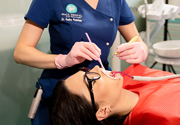 MallDental profilaxie