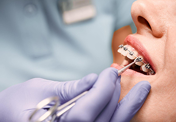 MallDental-ortodontie