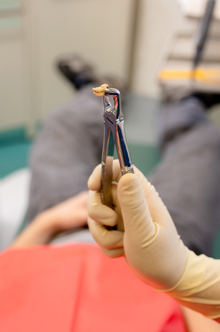MallDental-servicii-chirurgie-dento-alveolara-1